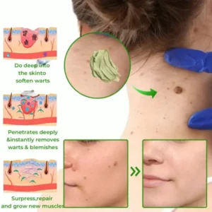 Instant Mole & Spot Cream - Image 11