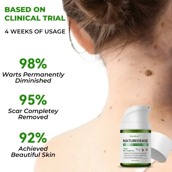Instant Mole & Spot Cream - Image 2