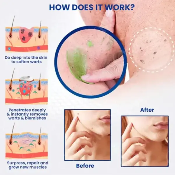 Spot Removal Gel - Image 8