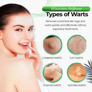 Wart Wipeout Soap - Image 4