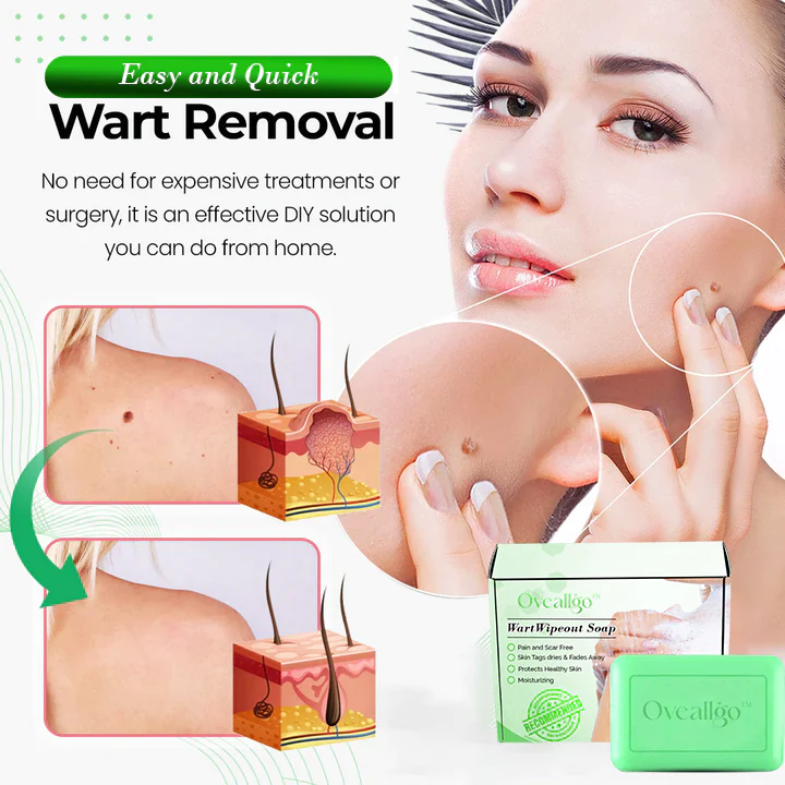 Wart Wipeout Soap - Image 3