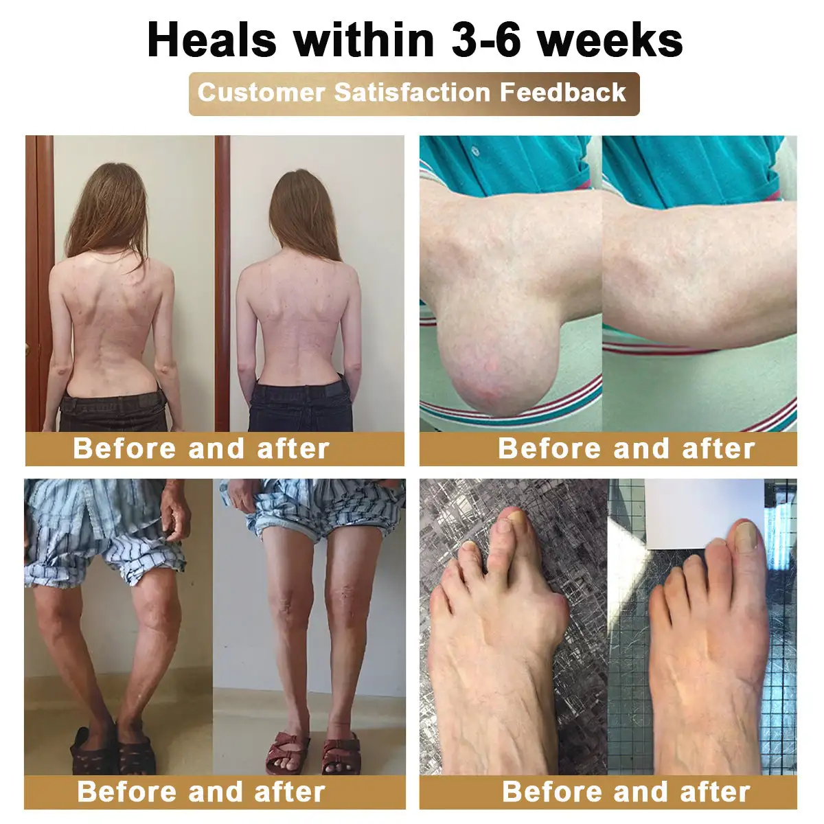 Bee Venom & Botulinum Toxin Joint Pain Relief & Repair Cream– Fast Relief & Joint Repair - Image 8