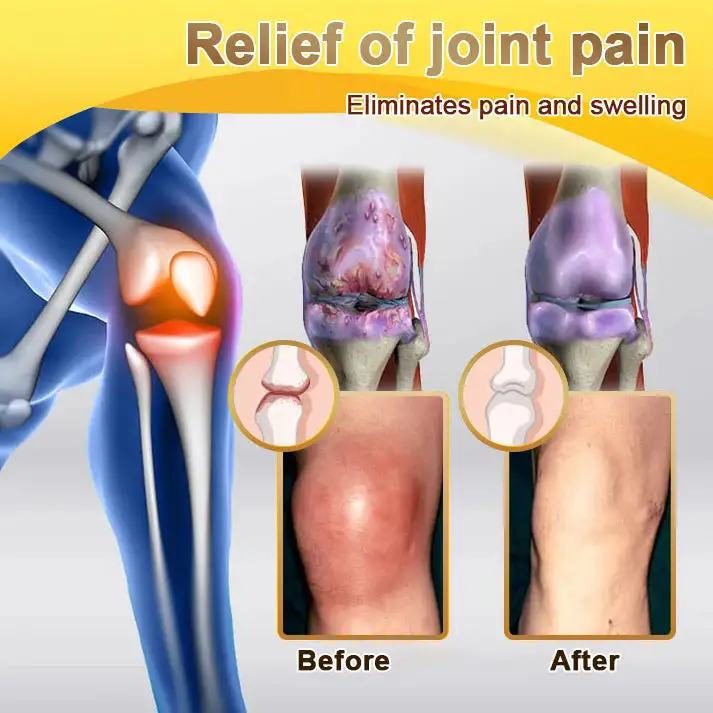 Bee Venom & Botulinum Toxin Joint Pain Relief & Repair Cream– Fast Relief & Joint Repair - Image 12