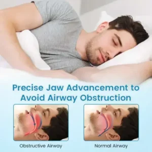 Anti-Snoring & Anti-Grinding Teeth Protector - Image 6