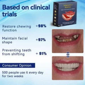 Adsorptive Dentures - Image 6