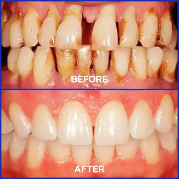 VioGloss Bee Venom Dental Therapy Oral Power🦷 - Image 10