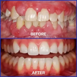 VioGloss Bee Venom Dental Therapy Oral Power🦷 - Image 9