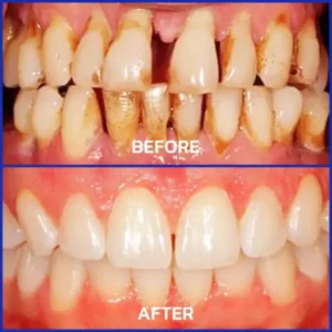 Bienengift-Zahntherapie Oral Power - Image 7