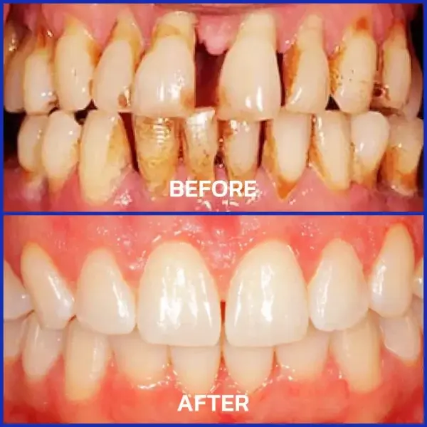 Bienengift-Zahntherapie Oral Power - Image 7