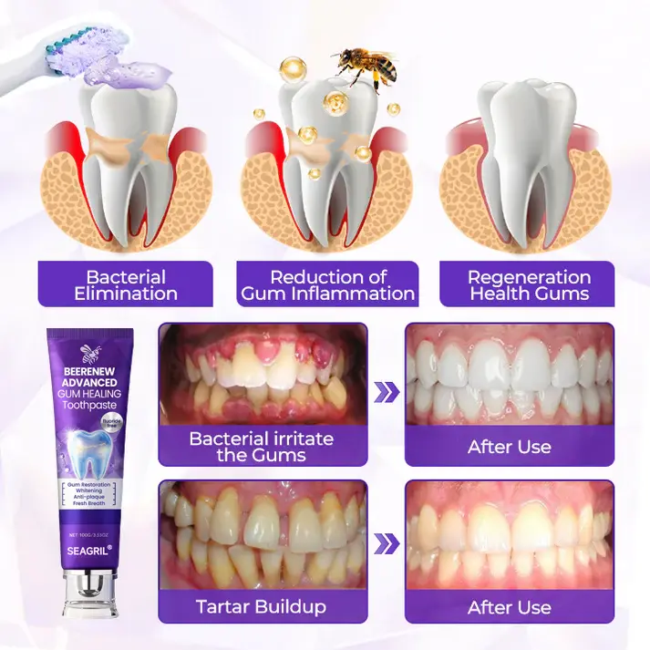 Advanced Gum Healing Toothpaste - Image 6