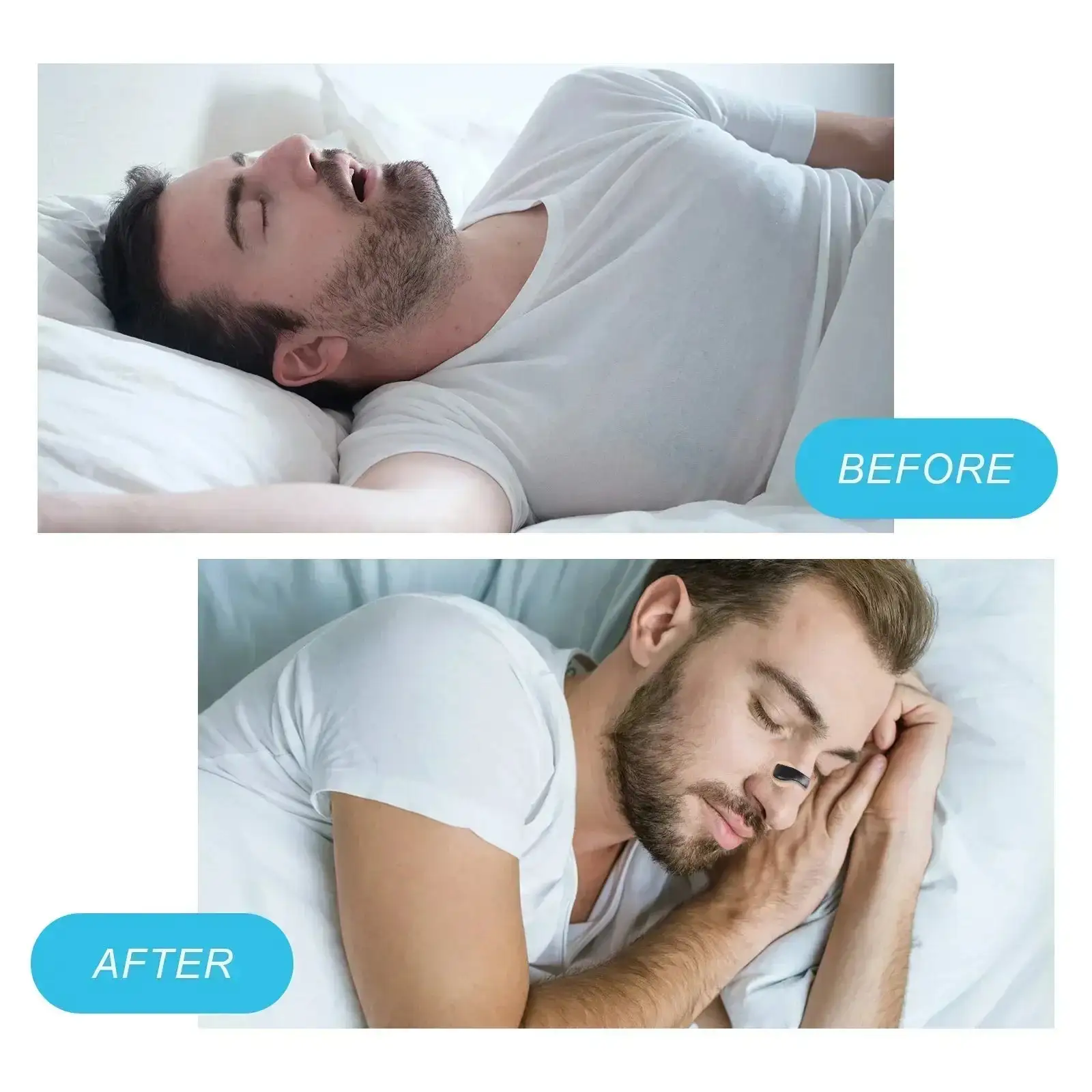 Nasal Breathing Dilators - Image 8