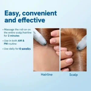 Advanced Anti-Hair Loss Roll-On – See hair growth in 1-2 weeks - Image 3