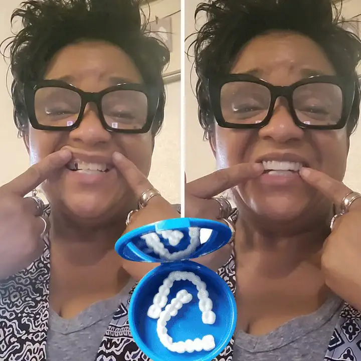 Affordable Denture Solution to Restore Your Natural Smile at Home - Image 4