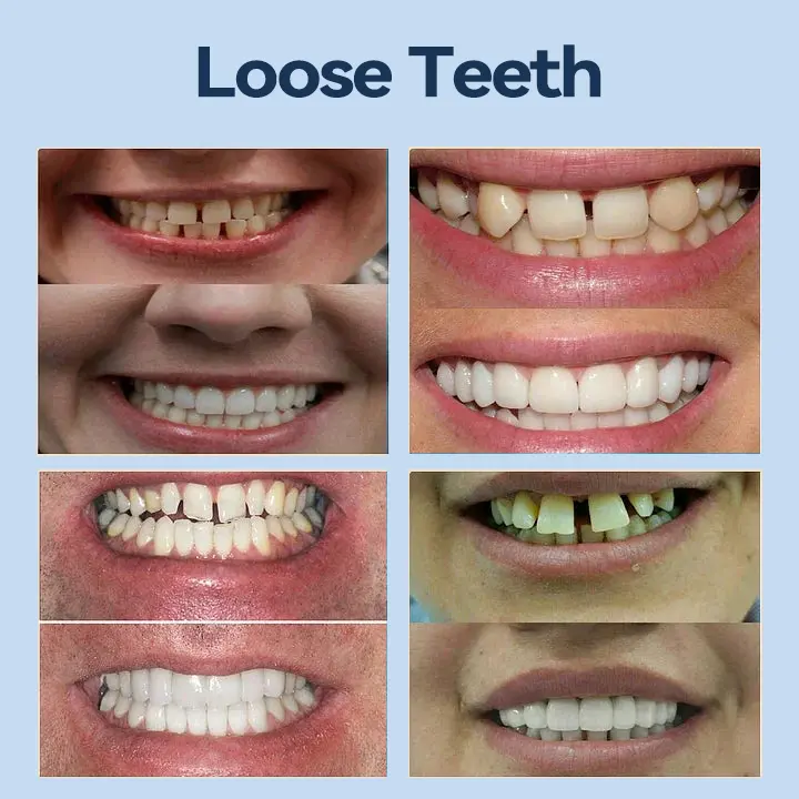 𝐀𝐝𝐚𝐩𝐭𝐢𝐯𝐞 𝐃𝐞𝐧𝐭𝐮𝐫𝐞𝐬 - Image 10