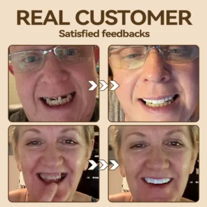 🐱🐉💦- 𝐏𝐫𝐞𝐦𝐢𝐮𝐦 𝐃𝐞𝐧𝐭𝐮𝐫𝐞- (✨Suitable for all mouth shapes, custom-made dentures for a perfect fit✨) - Image 8