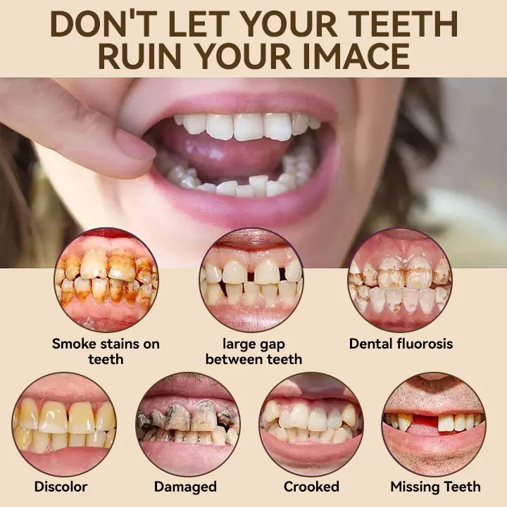 🐱🐉💦- 𝐏𝐫𝐞𝐦𝐢𝐮𝐦 𝐃𝐞𝐧𝐭𝐮𝐫𝐞- (✨Suitable for all mouth shapes, custom-made dentures for a perfect fit✨) - Image 9