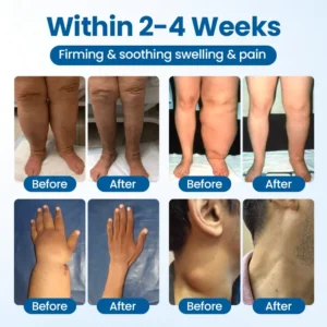Swelling Relief Roll-On - Image 6