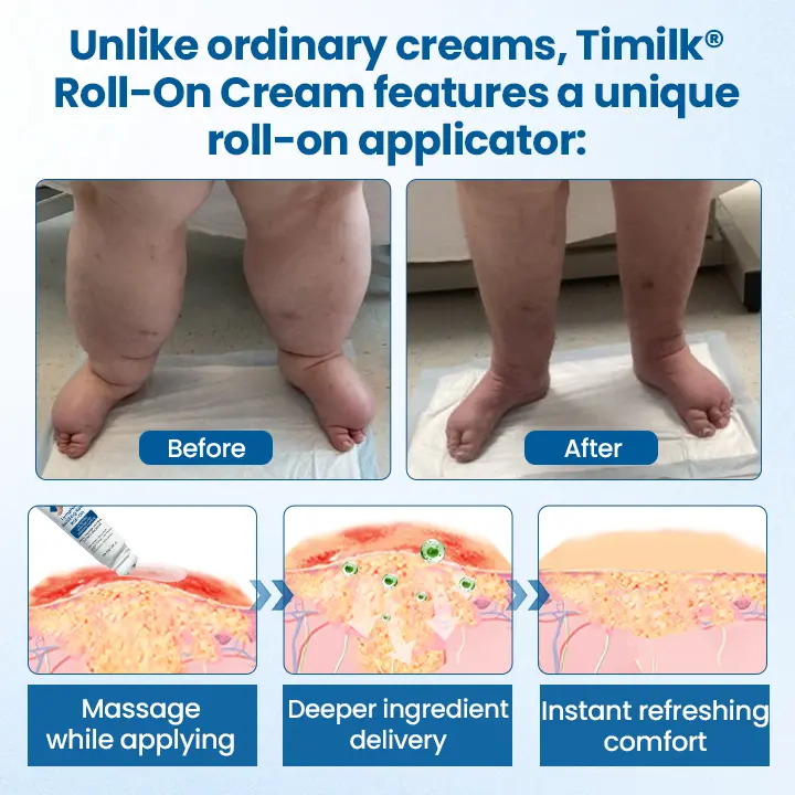 Swelling Relief Roll-On - Image 7