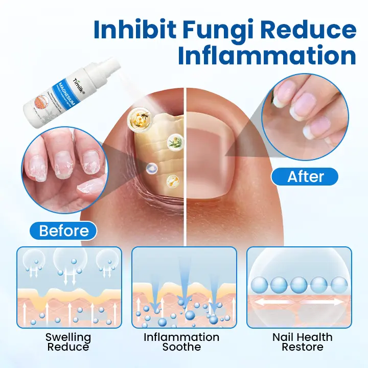 Magnesium Herbal Treatment Spray - Image 6
