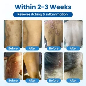 Magnesium Herbal Treatment Spray - Image 10