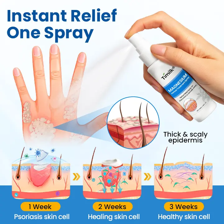 Magnesium Herbal Treatment Spray - Image 5