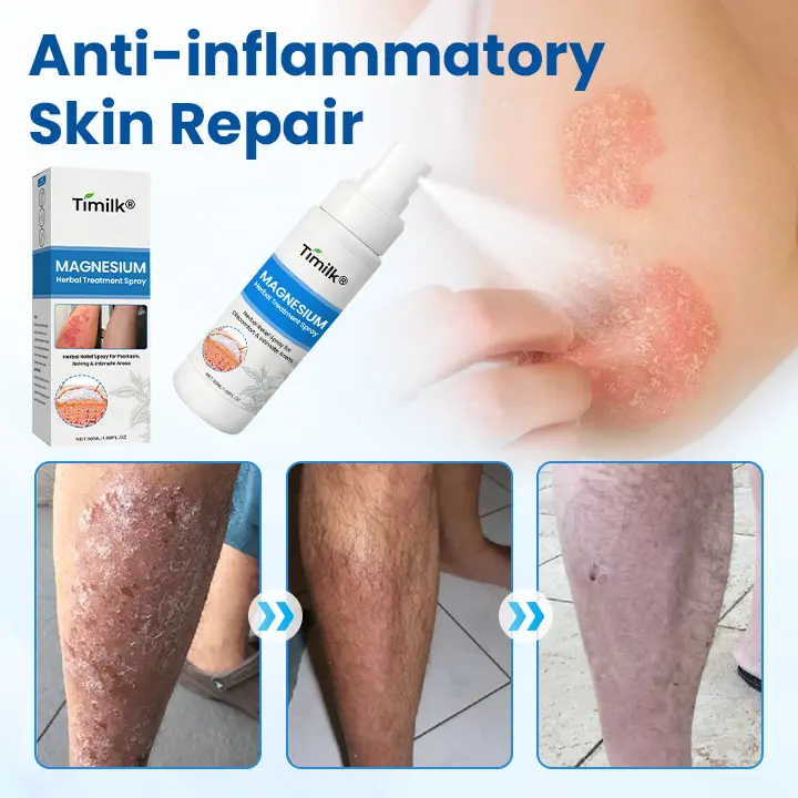 Magnesium Herbal Treatment Spray - Image 4