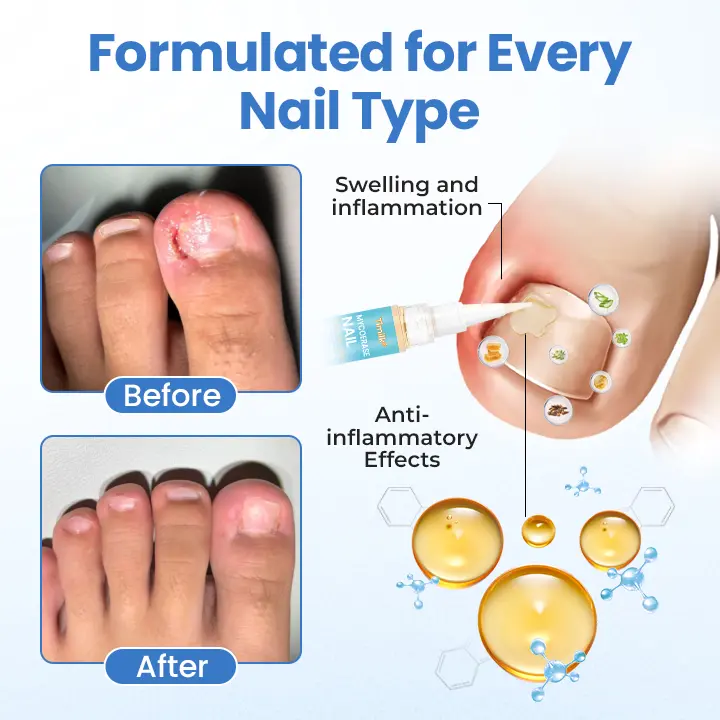Nail Revive Pen - Image 10