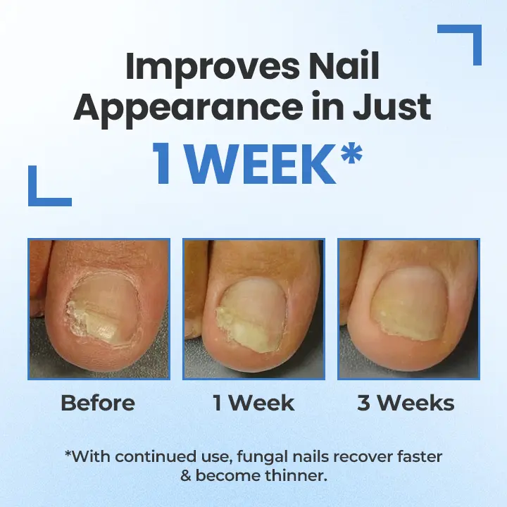 Nail Revive Pen - Image 9