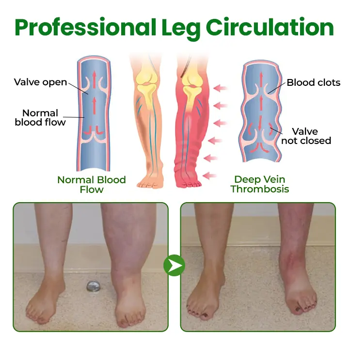 VenoLift Leg Relief Spray - Image 8