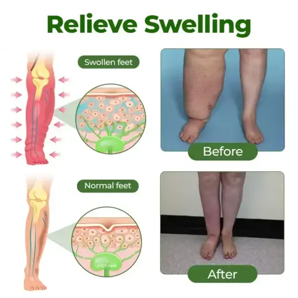 Professional Leg Circulation Cream - Image 5
