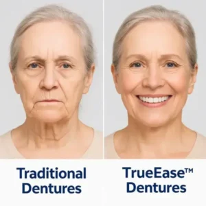 Dentures Set - Image 5