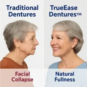 TrueEase Dentures - Image 4