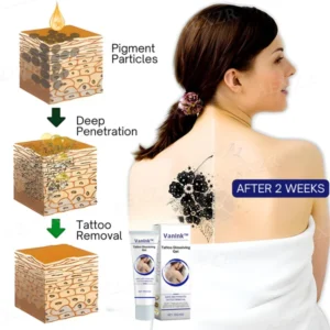 Tattoo Dissolving Gel - Image 8