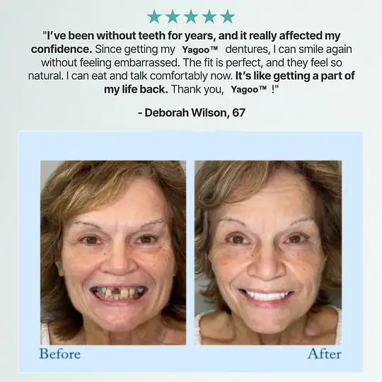 🦷Advanced Customized Full Denture Set🦷 (🔥10,000+ Sold In Last 30 Day) - Image 12