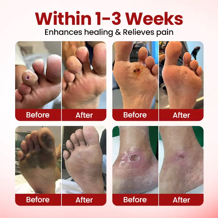 Diabetic Care Cream - Image 5