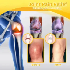 Bee Venom-Infused Relief for Bones - Image 3