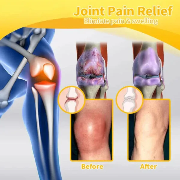 Bee Venom-Infused Relief for Bones - Image 3