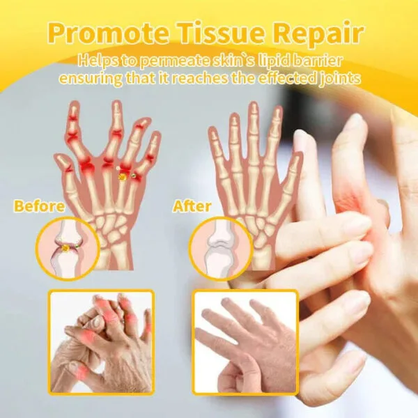 Bee Venom-Infused Relief for Bones - Image 6