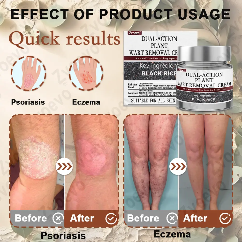 Rice Bran Essence Cream - Image 18