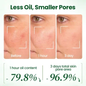 Avocado Acid Mask - Image 6
