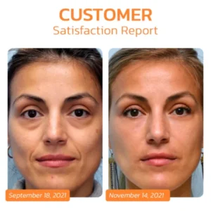 Korean Dermalayr Technology Soluble Collagen Film - Image 5