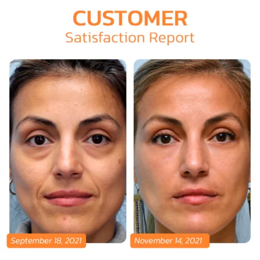 Korean Dermalayr Technology Soluble Collagen Film - Image 5
