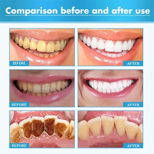 Herbal Brightening Oral Repair Foam - Image 4