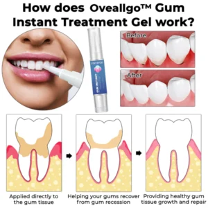 Gum Instant Treatment Gel - Image 3