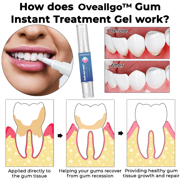 Gum Instant Treatment Gel - Image 3