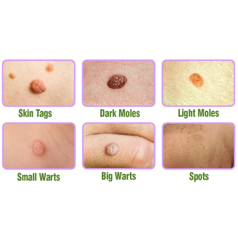 Herbal Treatment Serum - Image 8