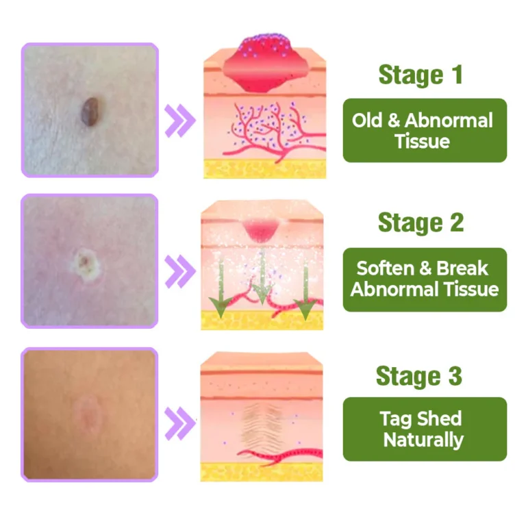 Herbal Treatment Serum - Image 6