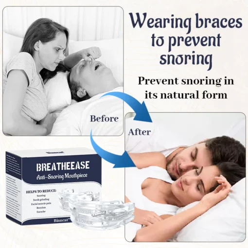 Anti-Snoring Mouthpiece - Image 3