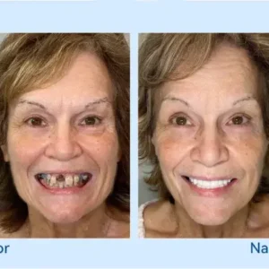 🦷𝐅𝐨𝐫𝐭𝐬𝐜𝐡𝐫𝐢𝐭𝐭𝐥𝐢𝐜𝐡 𝐌𝐚ß𝐠𝐞𝐟𝐞𝐫𝐭𝐢𝐠𝐭 𝐕𝐨𝐥𝐥𝐩𝐫𝐨𝐭𝐡𝐞𝐬𝐞𝐧-𝐒𝐞𝐭 - Image 10