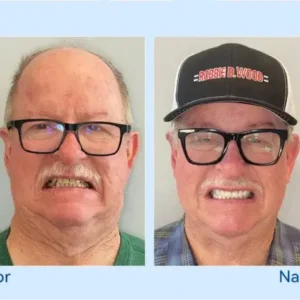 🦷𝐅𝐨𝐫𝐭𝐬𝐜𝐡𝐫𝐢𝐭𝐭𝐥𝐢𝐜𝐡 𝐌𝐚ß𝐠𝐞𝐟𝐞𝐫𝐭𝐢𝐠𝐭 𝐕𝐨𝐥𝐥𝐩𝐫𝐨𝐭𝐡𝐞𝐬𝐞𝐧-𝐒𝐞𝐭 - Image 12
